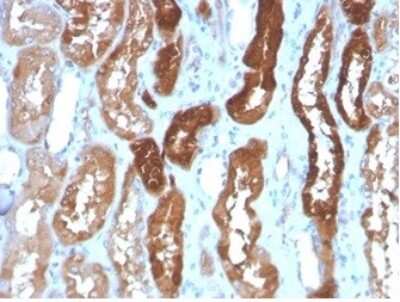 Immunohistochemistry-Paraffin: FABP3/H-FABP Antibody (FABP3/3430) [NBP3-13881]