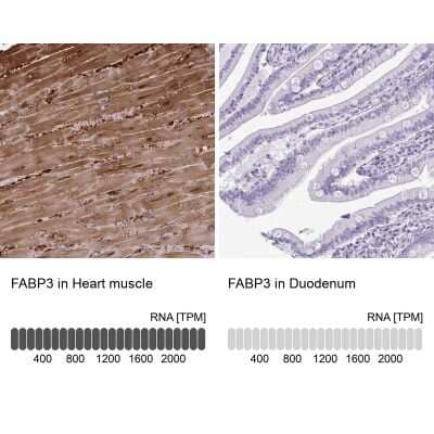 Immunohistochemistry-Paraffin: FABP3/H-FABP Antibody [NBP2-33763]