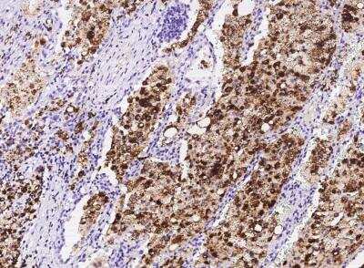 Immunohistochemistry-Paraffin: FABP4/A-FABP Antibody (001) [NBP2-90054]