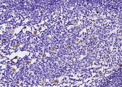 Immunohistochemistry-Paraffin: FABP4/A-FABP Antibody (001) [NBP2-90054]