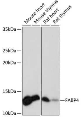 Western Blot: FABP4/A-FABP Antibody (1N6B4) [NBP3-15390]