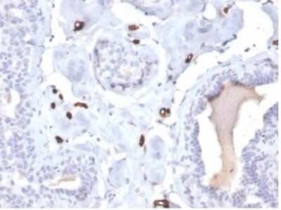 Immunohistochemistry-Paraffin: FABP4/A-FABP Antibody (FABP4/4422) [NBP3-13879]
