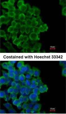 Immunocytochemistry/ Immunofluorescence: FABP4/A-FABP Antibody [NBP1-33616]