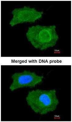 Immunocytochemistry/ Immunofluorescence: FABP4/A-FABP Antibody [NBP1-33616]