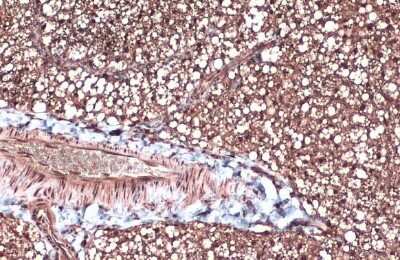 Immunohistochemistry-Paraffin: FABP4/A-FABP Antibody [NBP1-33616]
