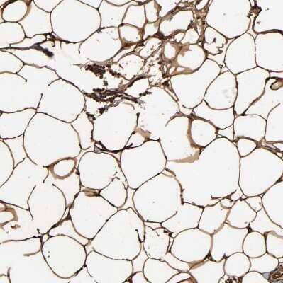 Immunohistochemistry-Paraffin: FABP4/A-FABP Antibody [NBP1-89218]