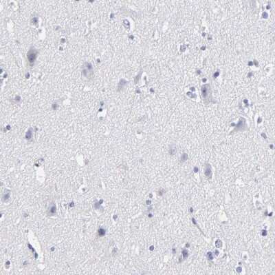 Immunohistochemistry-Paraffin: FABP4/A-FABP Antibody [NBP1-89218]