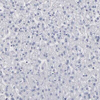 Immunohistochemistry-Paraffin: FABP4/A-FABP Antibody [NBP1-89218]
