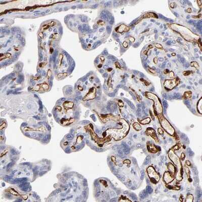 Immunohistochemistry-Paraffin: FABP4/A-FABP Antibody [NBP1-89218]