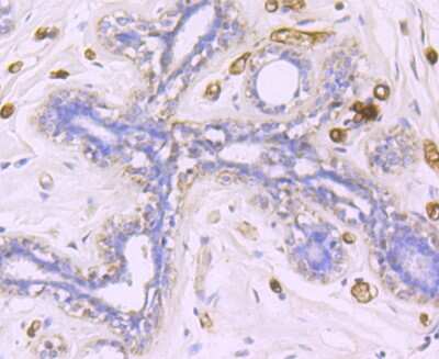 Immunohistochemistry-Paraffin: FABP4/A-FABP Antibody (JM10-99) [NBP2-66828]