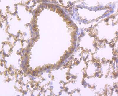Immunohistochemistry-Paraffin: FABP4/A-FABP Antibody (JM10-99) [NBP2-66828]