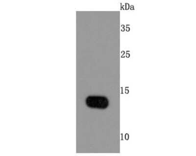 Western Blot: FABP4/A-FABP Antibody (JM10-99) [NBP2-66828]