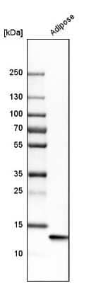 Western Blot: FABP4/A-FABP Antibody [NBP1-89218]