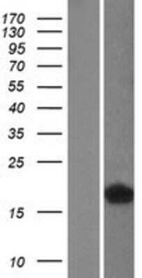 Western Blot: FABP4/A-FABP Overexpression Lysate [NBL1-10420]