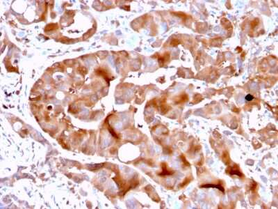 Immunohistochemistry-Paraffin: FABP5/E-FABP Antibody (FABP5/3750) [NBP2-79795]