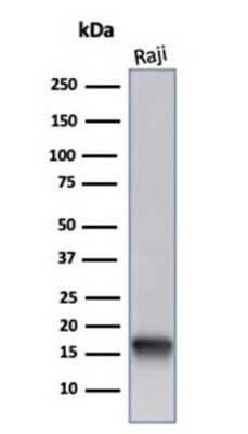 Western Blot: FABP5/E-FABP Antibody (FABP5/6353R) [NBP3-13882]