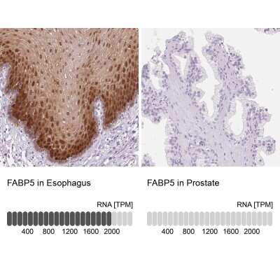 Immunohistochemistry-Paraffin: FABP5/E-FABP Antibody [NBP2-38659]