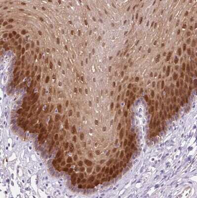 Immunohistochemistry-Paraffin: FABP5/E-FABP Antibody [NBP2-38659]