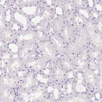 Immunohistochemistry-Paraffin: FABP5/E-FABP Antibody [NBP2-38659]