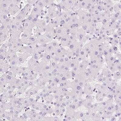 Immunohistochemistry-Paraffin: FABP5/E-FABP Antibody [NBP2-38659]