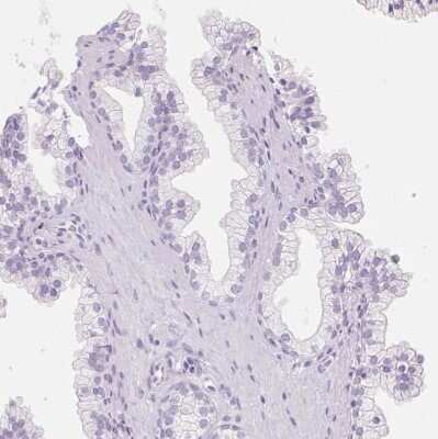 Immunohistochemistry-Paraffin: FABP5/E-FABP Antibody [NBP2-38659]
