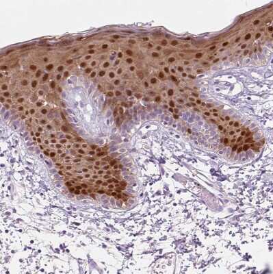 Immunohistochemistry-Paraffin: FABP5/E-FABP Antibody [NBP2-38659]