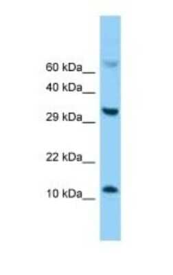 Western Blot: FABP5/E-FABP Antibody [NBP1-98462]