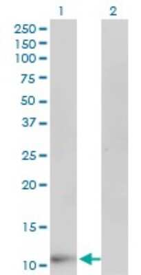 Western Blot: FABP6 Antibody (4A4) [H00002172-M01]