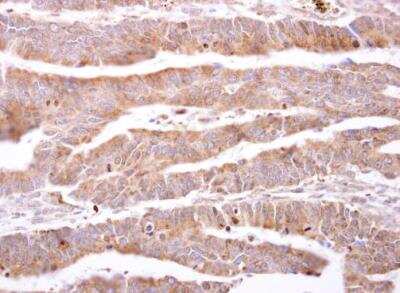 Immunohistochemistry-Paraffin: FABP6 Antibody [NBP1-32482]