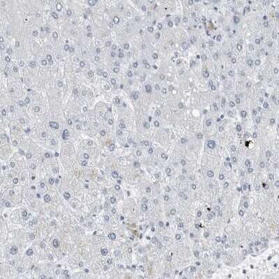 Immunohistochemistry-Paraffin: FABP6 Antibody [NBP1-83129]