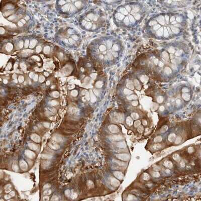 Immunohistochemistry-Paraffin: FABP6 Antibody [NBP1-83129]