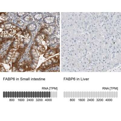 Immunohistochemistry-Paraffin: FABP6 Antibody [NBP1-83129]