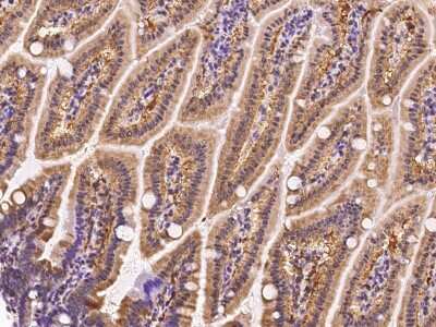 Immunohistochemistry-Paraffin: FABP6 Antibody [NBP2-99577]