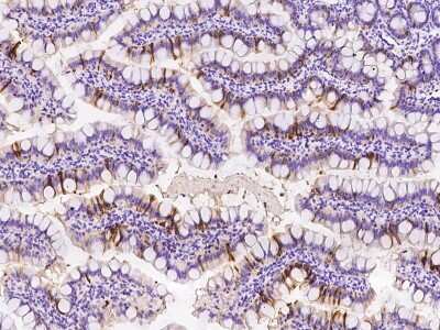 Immunohistochemistry-Paraffin: FABP6 Antibody [NBP2-99577]