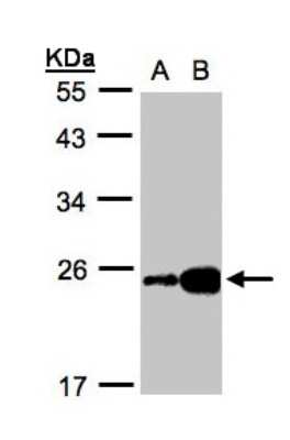 Western Blot: FABP6 Antibody [NBP1-32482]