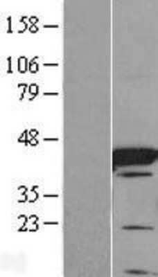 Western Blot: FABP6 Overexpression Lysate [NBL1-10422]