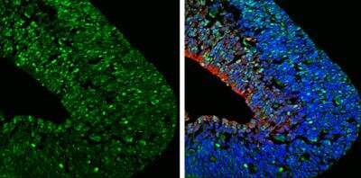 Immunohistochemistry-Frozen: FABP7/B-FABP Antibody [NBP2-16399]