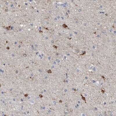 Immunohistochemistry-Paraffin: FABP7/B-FABP Antibody [NBP1-88648]