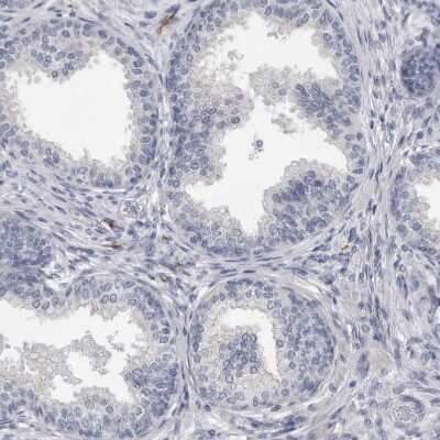 Immunohistochemistry-Paraffin: FABP7/B-FABP Antibody [NBP1-88648]