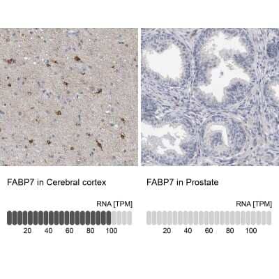 Immunohistochemistry-Paraffin: FABP7/B-FABP Antibody [NBP1-88648]