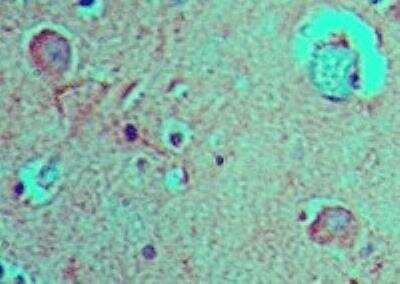 Immunohistochemistry-Paraffin: FABP7/B-FABP Antibody [NBP2-27073]