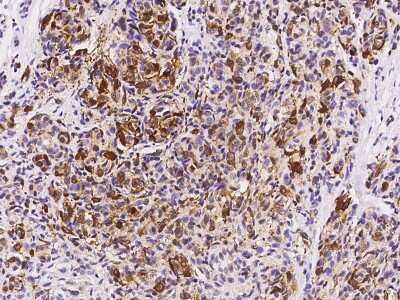 Immunohistochemistry-Paraffin: FABP7/B-FABP Antibody [NBP3-00016]