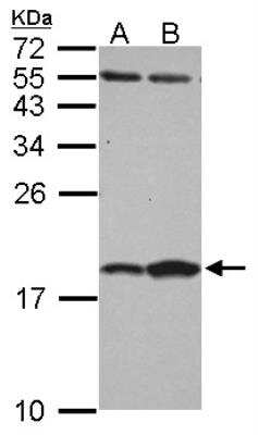 Western Blot: FABP7/B-FABP Antibody [NBP2-16399]