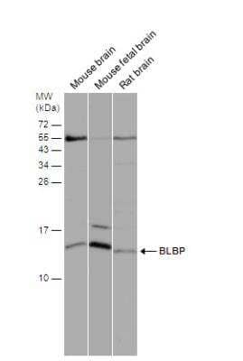 Western Blot: FABP7/B-FABP Antibody [NBP2-16399]