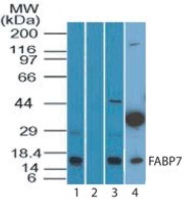 Western Blot: FABP7/B-FABP Antibody [NBP2-27073]