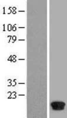 Western Blot: FABP7/B-FABP Overexpression Lysate [NBL1-10423]