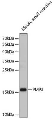 Western Blot: FABP8/M-FABP/Myelin P2 Protein AntibodyBSA Free [NBP3-03262]