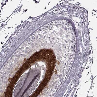 Immunohistochemistry: FABP9/T-FABP Antibody [NBP2-68958]