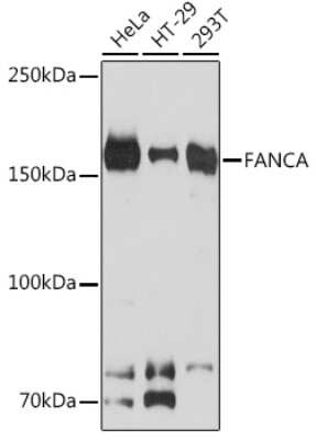 Western Blot: FACA/FANCA Antibody (4Q1Q8) [NBP3-16818]