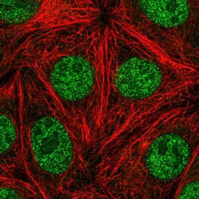 Immunocytochemistry/ Immunofluorescence: FACA/FANCA Antibody [NBP2-56898]